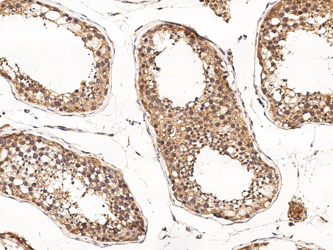 DSPG3 Antibody in Immunohistochemistry (Paraffin) (IHC (P))