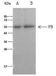 Factor IX Antibody in Immunoprecipitation (IP)