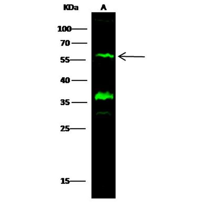 GFR alpha-2 Antibody in Western Blot (WB)