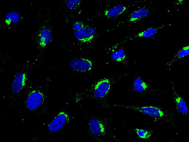 GOLPH2 Antibody in Immunocytochemistry (ICC/IF)