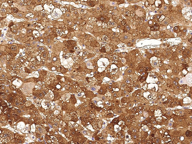 GOT2 Antibody in Immunohistochemistry (Paraffin) (IHC (P))