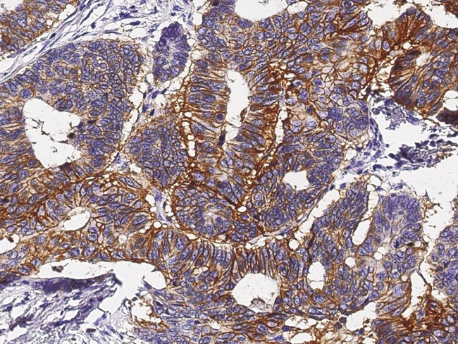 A33 Antibody in Immunohistochemistry (Paraffin) (IHC (P))