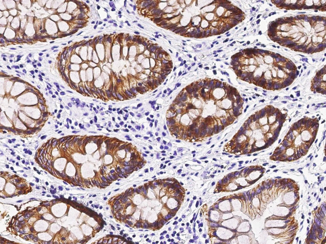 A33 Antibody in Immunohistochemistry (Paraffin) (IHC (P))