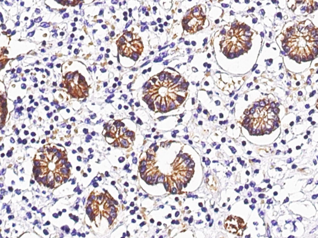 A33 Antibody in Immunohistochemistry (Paraffin) (IHC (P))