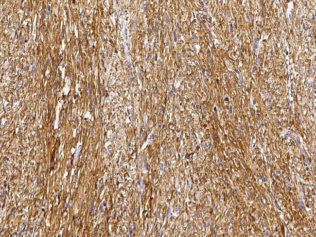 GSTM2 Antibody in Immunohistochemistry (Paraffin) (IHC (P))