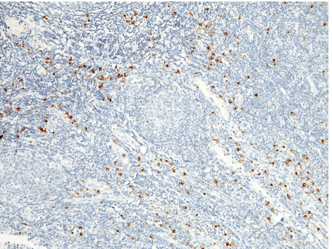 Granzyme B Antibody in Immunohistochemistry (Paraffin) (IHC (P))