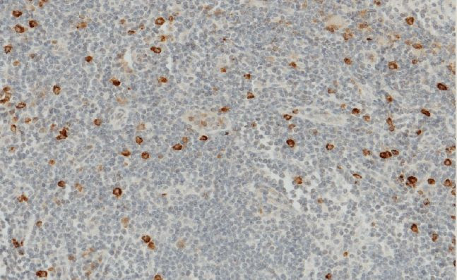 Granzyme B Antibody in Immunohistochemistry (Paraffin) (IHC (P))