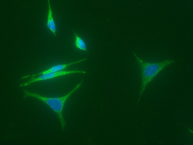 15-PGDH Antibody in Immunocytochemistry (ICC/IF)