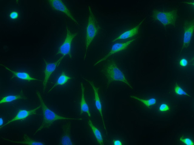 15-PGDH Antibody in Immunocytochemistry (ICC/IF)