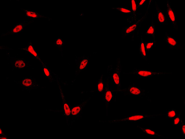 HSF1 Antibody in Immunocytochemistry (ICC/IF)