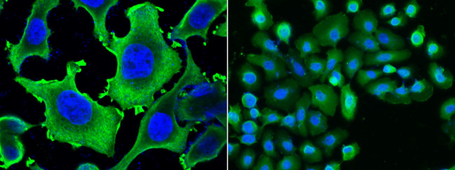 HSP27 Antibody in Immunocytochemistry (ICC/IF)