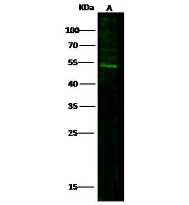 IFNGR1 Antibody in Western Blot (WB)