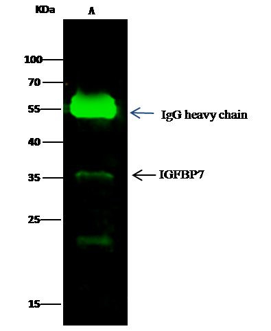 IGFBP7 Antibody in Immunoprecipitation (IP)