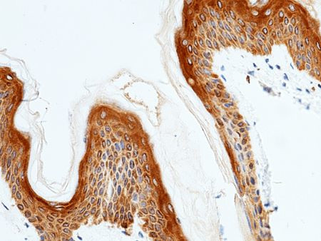 IL20RA Antibody in Immunohistochemistry (Paraffin) (IHC (P))