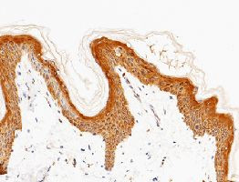 IL20RA Antibody in Immunohistochemistry (Paraffin) (IHC (P))