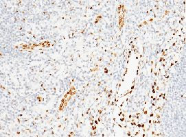 IL-33 Antibody in Immunohistochemistry (Paraffin) (IHC (P))