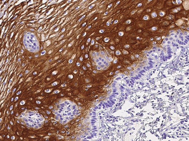 IL1F9 Antibody in Immunohistochemistry (Paraffin) (IHC (P))