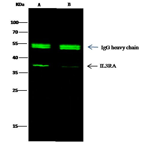 CD123 Antibody in Immunoprecipitation (IP)