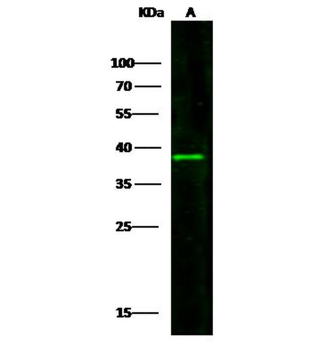 CD123 Antibody in Western Blot (WB)