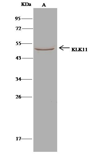 Kallikrein 11 Antibody in Immunoprecipitation (IP)