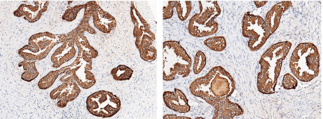 PSA Antibody in Immunohistochemistry (Paraffin) (IHC (P))