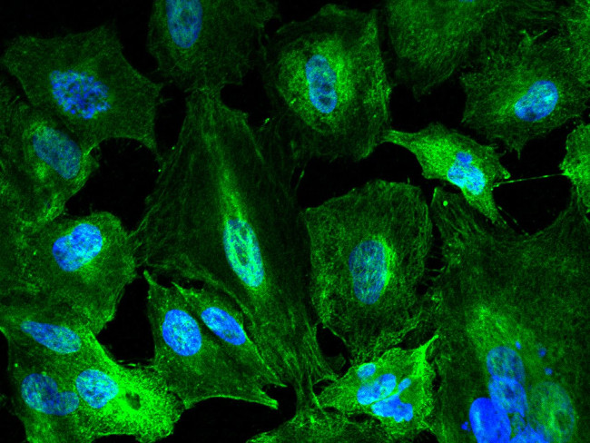 KYNU Antibody in Immunocytochemistry (ICC/IF)