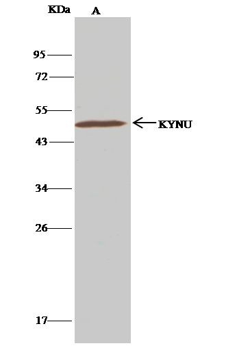 KYNU Antibody in Immunoprecipitation (IP)