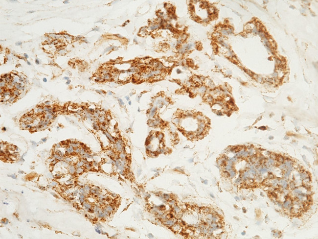 LAMP1 Antibody in Immunohistochemistry (Paraffin) (IHC (P))