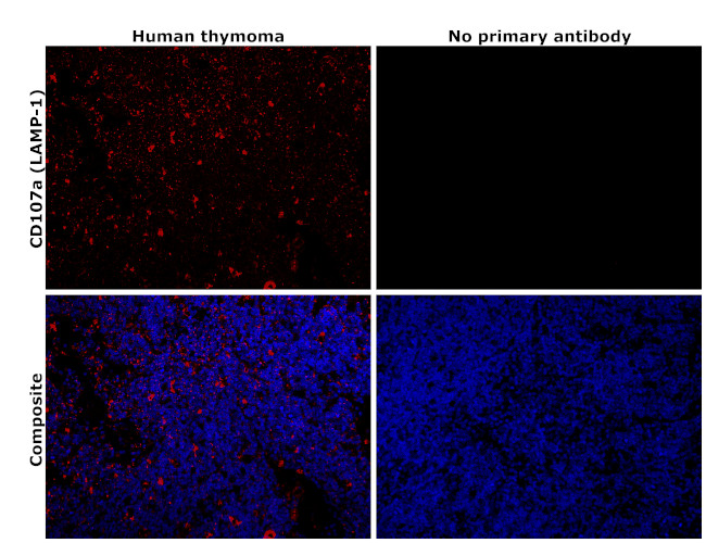 LAMP1 Antibody in Immunohistochemistry (Paraffin) (IHC (P))