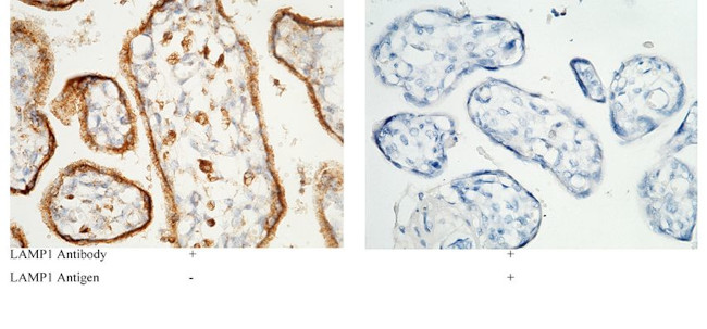 LAMP1 Antibody in Immunohistochemistry (Paraffin) (IHC (P))