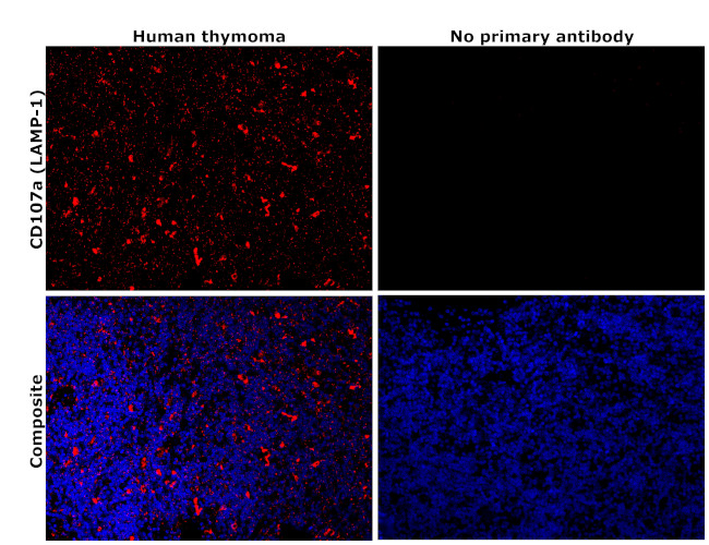 LAMP1 Antibody in Immunohistochemistry (Paraffin) (IHC (P))