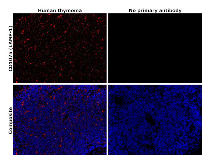 LAMP1 Antibody in Immunohistochemistry (Paraffin) (IHC (P))