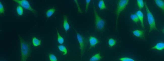 LAMP3 Antibody in Immunocytochemistry (ICC/IF)