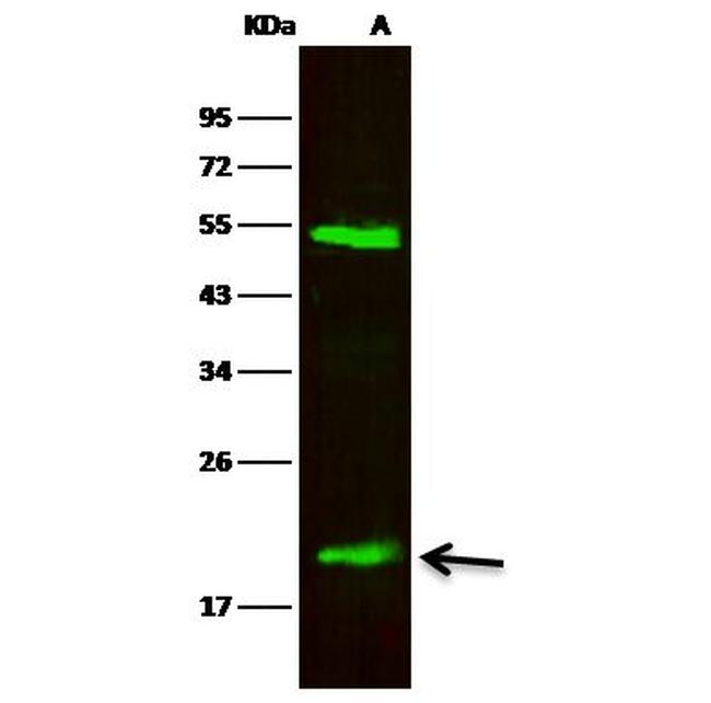 NGAL Antibody in Western Blot (WB)