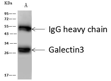 Galectin 3 Antibody in Immunoprecipitation (IP)