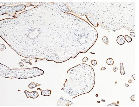 LIFR Antibody in Immunohistochemistry (Paraffin) (IHC (P))