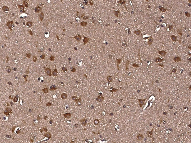 RAP Antibody in Immunohistochemistry (Paraffin) (IHC (P))