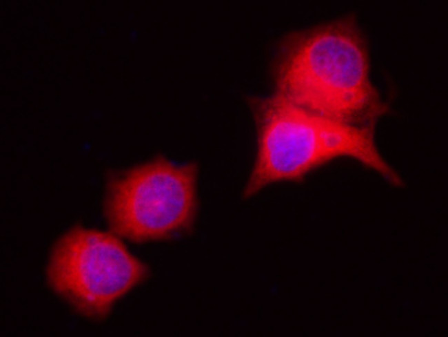 RAP Antibody in Immunocytochemistry (ICC/IF)