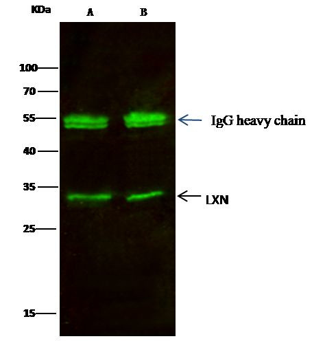 Latexin Antibody in Immunoprecipitation (IP)