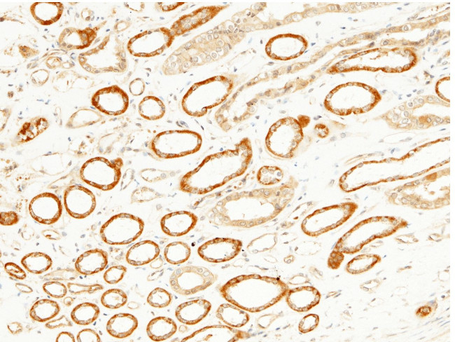 JNK2 Antibody in Immunohistochemistry (Paraffin) (IHC (P))