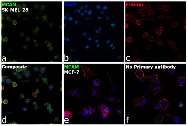 CD146 Antibody in Immunocytochemistry (ICC/IF)