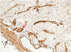 CD146 Antibody in Immunohistochemistry (Paraffin) (IHC (P))