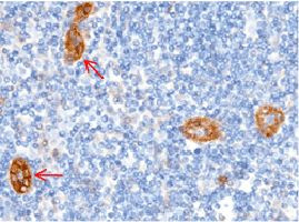 CD146 Antibody in Immunohistochemistry (Paraffin) (IHC (P))