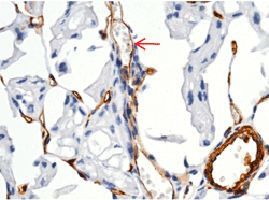 CD146 Antibody in Immunohistochemistry (Paraffin) (IHC (P))