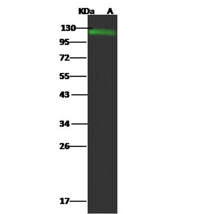 CD146 Antibody in Western Blot (WB)