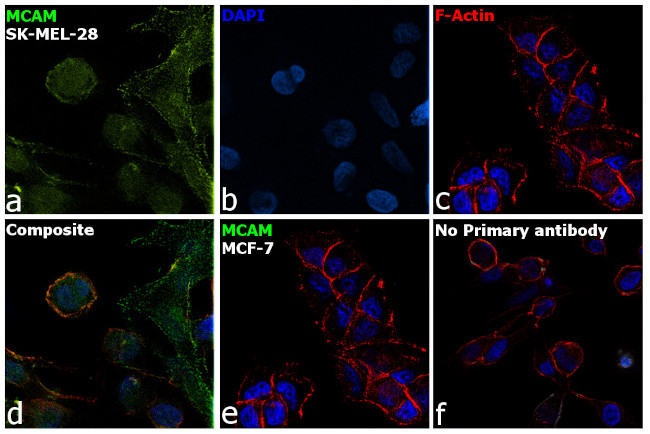 CD146 Antibody in Immunocytochemistry (ICC/IF)