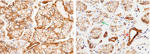 CD146 Antibody in Immunohistochemistry (Paraffin) (IHC (P))