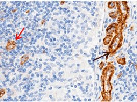 CD146 Antibody in Immunohistochemistry (Paraffin) (IHC (P))