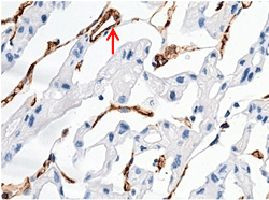 CD146 Antibody in Immunohistochemistry (Paraffin) (IHC (P))