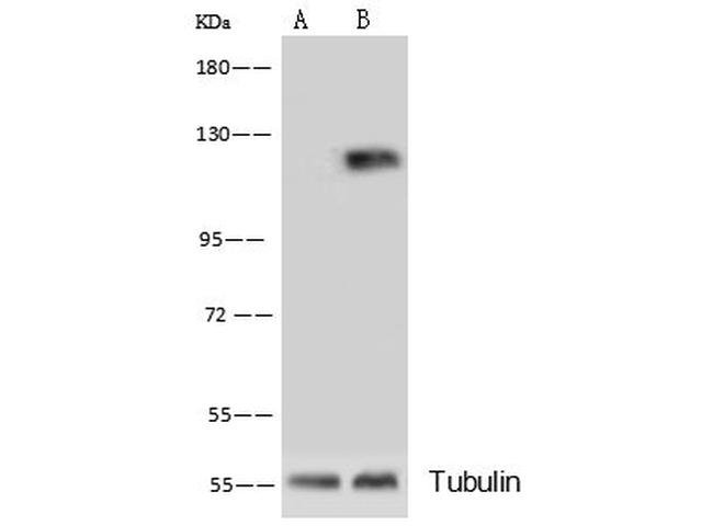 CD146 Antibody in Western Blot (WB)